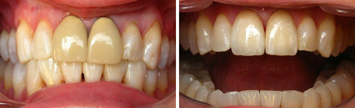 before and after image