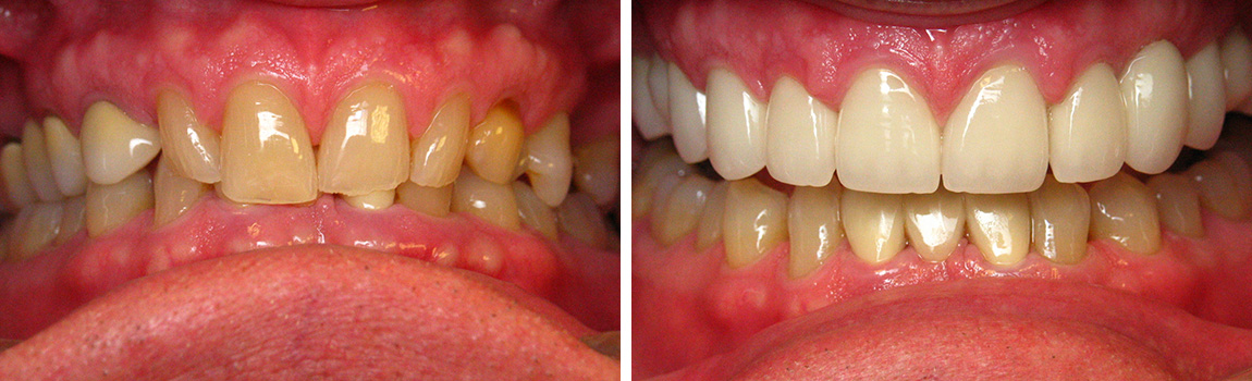 before and after image