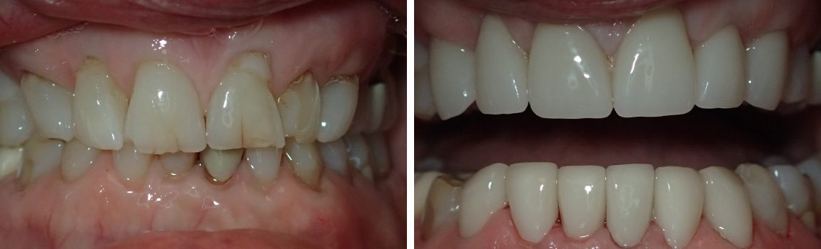 before and after image