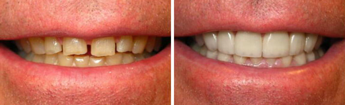 before and after image