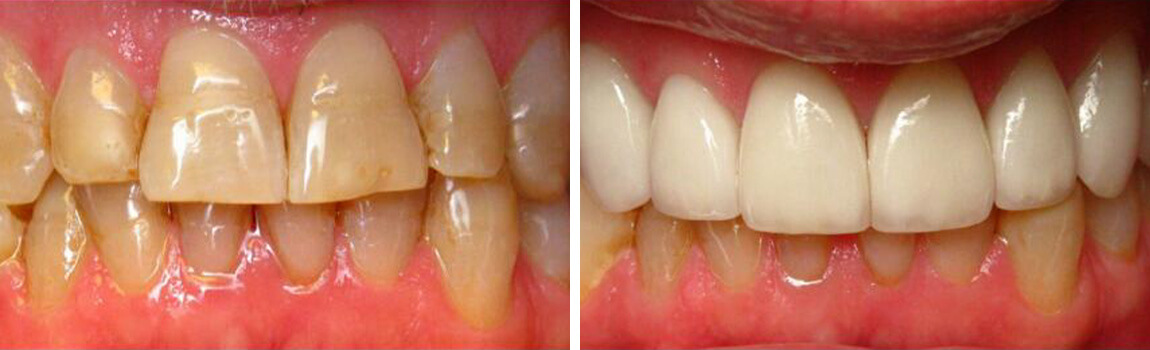 before and after image